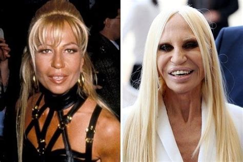 versace owner donatella|donatella versace before and after surgery.